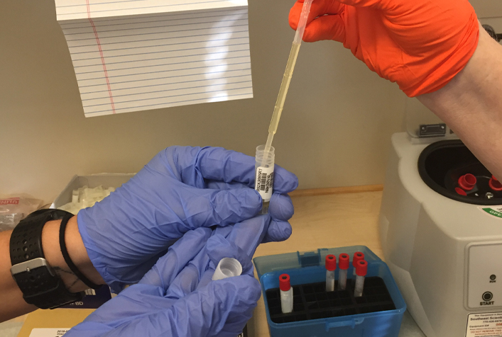 Serum for PFAS analysis being pipetted into a small labeled cryovial